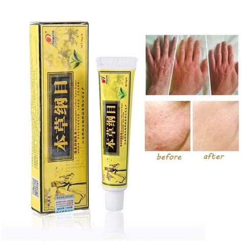 Original Advanced Psoriasis & Eczema Natural Herbal Cream – Smiles And Joys