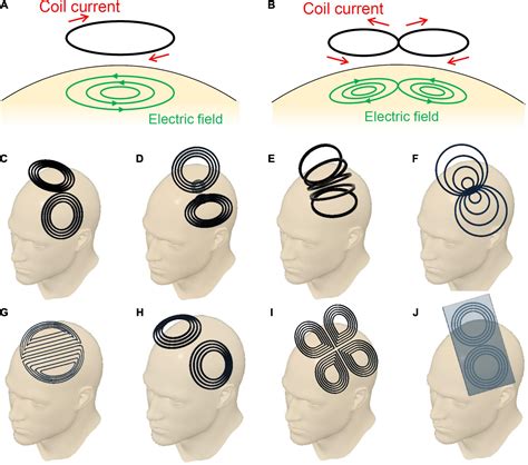 Frontiers | Figure-Eight Coils for Magnetic Stimulation: From Focal ...