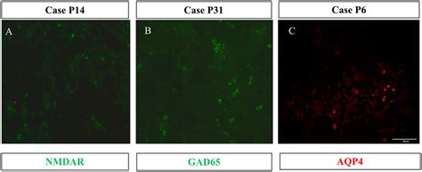 MRI findings of three patients with autoantibody-positive... | Download Scientific Diagram