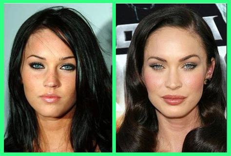 Plastic Surgery Before And After: Megan Fox Before And After