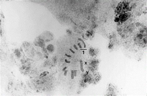 CHROMOSOMES OF THE CARIBBEAN FRUIT FLY (DIPTERA: TEPHRITIDAE)