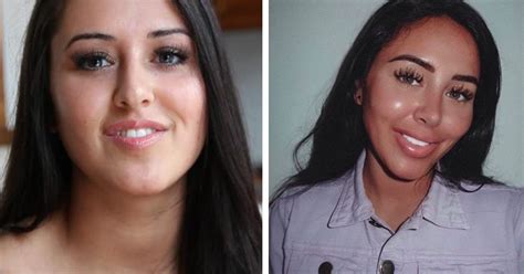 Geordie Shore before and after: what did the cast look like before surgery?