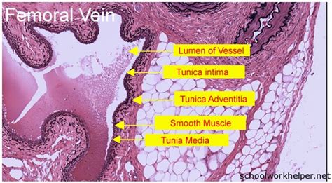 Femoral-Vein-slide-labelled-histology | SchoolWorkHelper