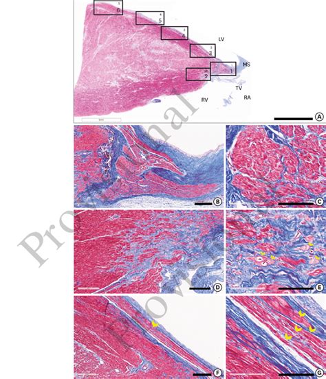 Histological sections of the ventricular septum reveal the bundle of... | Download Scientific ...