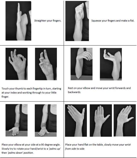 Distal Radius Fracture - GC Hand Therapy