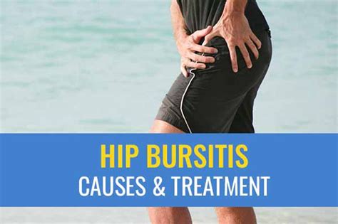 Hip bursitis – Causes and treatment