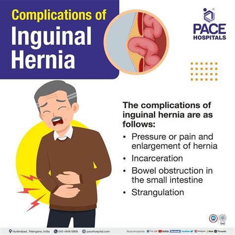 Inguinal Hernia - Signs and Symptoms, Types, Causes, Risk Factors