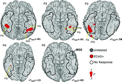 | Mapping results of ECoG for face perception. Face selective ECoG... | Download Scientific Diagram