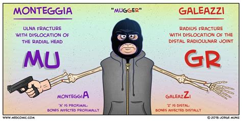 Monteggia vs Galeazzi MUGR (pronounced “MUGGER”): identifies the fractured bone. MU: Monteggia ...