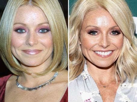 Kelly Ripa Plastic Surgery - Everything You Need to Know! | Glamour Fame