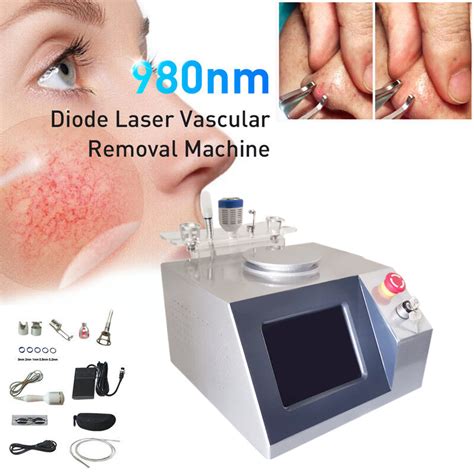 Couperose Skin Treatment Leg Veins Removal Fast Vascular Vein/Varicose/Capillary Removal Machine ...