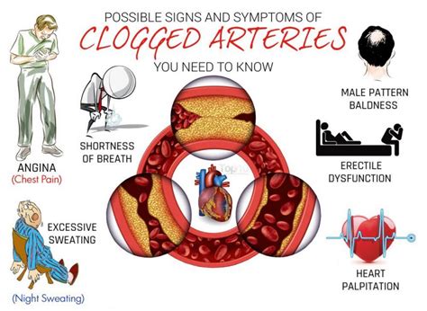 Atherosclerosis | Getcured Apothecary Pvt Ltd