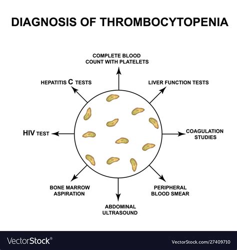 Diagnosis thrombocytopenia lowering platelets Vector Image