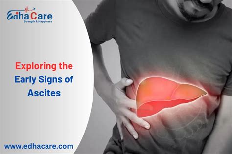 Uncovering the Early Stage Ascites Symptoms