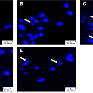 Morphological changes and induction of chromatin condensation in AGS... | Download Scientific ...