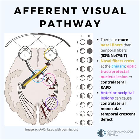 The Afferent Visual Pathway — Ophthalmology Review