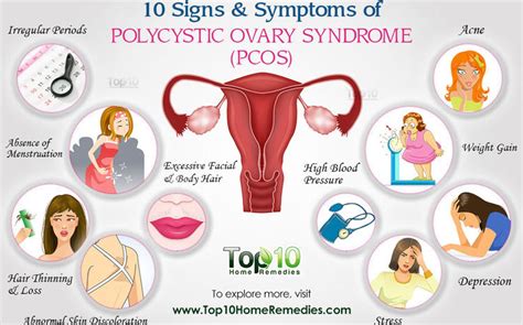 Understanding Polycystic Ovarian Syndrome | The Herald