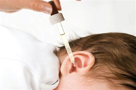 3 Tips Hydrogen peroxide in ear how it can help to ear wax removal drops