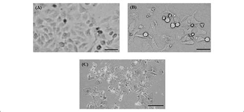 Alteration in morphology of human hepatocarcinoma (HepG2) cells. A ...