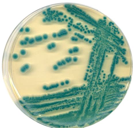 Bacillus Cereus Nutrient Agar