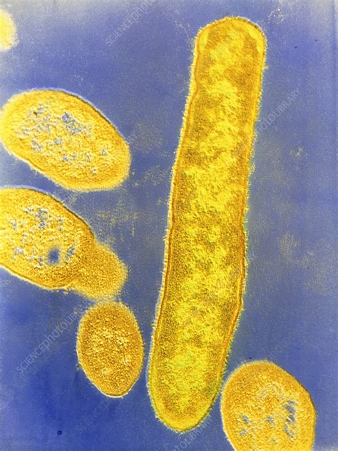 Bacteroides fragilis bacteria - Stock Image B220/0126 - Science Photo ...