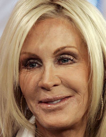 Chatter Busy: Joan Van Ark Plastic Surgery