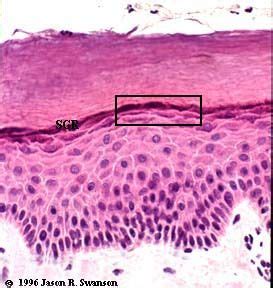 stratum granulosum Epidermis, Tissue, Acne, Meant To Be, Layers, Skin ...