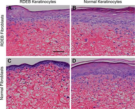 Keratinocytes Histology