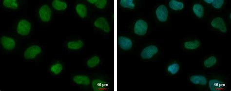 CREST Antibody (PA5-30571)