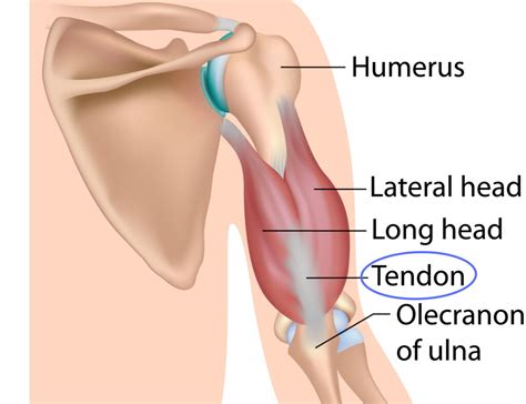 Triceps Tendonitis: The Weightlifter's Elbow - Sport Doctor London