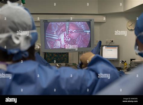 ENDOMETRIOSIS SURGERY Stock Photo - Alamy