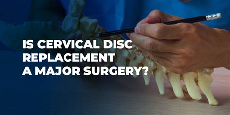 Cervical Disc Replacement Surgery | New York Spine Institute