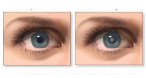 9 interesting things your eyes reveal about your health | TheHealthSite.com