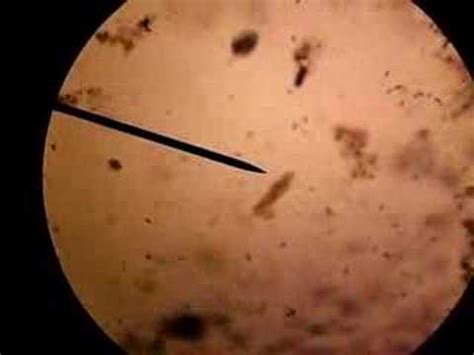 PROTISTA moving under microscope - YouTube