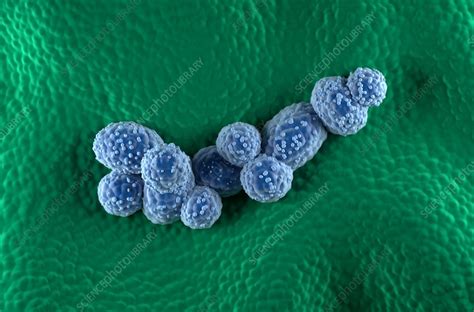 Prostate cancer, illustration - Stock Image - F040/3509 - Science Photo Library