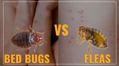 Bed Bug Bite Vs. Flea Bite Difference in Symptoms and Treatment