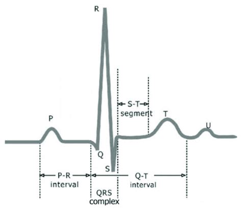 Ecg Of Normal Sinus Rhythm