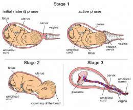 Stages of Labour and Collusion | Dr Rachel Reed