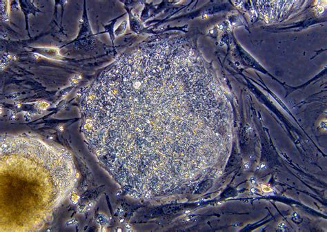 Neverland Research by Lab Fairy: Convertion of somatic cells into stem ...