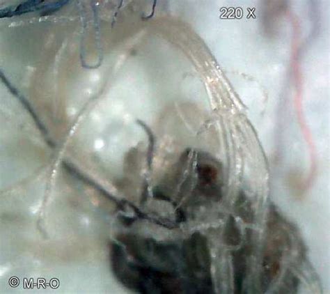 morgellons fibers