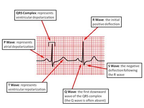 ER RN | P wave, Medical mnemonics, Nursing school studying