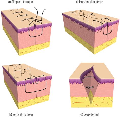 Best Mattresses of 2020 | Updated 2020 Reviews‎: Buried Vertical ...