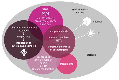 Clinical considerations in the diagnosis and management of systemic lupus erythematosus