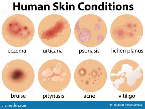 [DIAGRAM] Diagram Human Skin Conditions - MYDIAGRAM.ONLINE