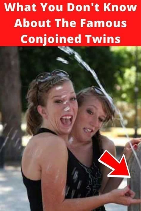 Abby and Brittany Hensel were born as conjoined twins in 1990. Their distinctiveness comes with ...