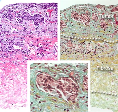 Structure of the Human Pericardium and Responses to Pathologic ...