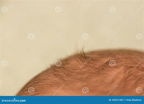 Hair of a Newborn Baby. Child Head, Fontanel on the Head Stock Image ...