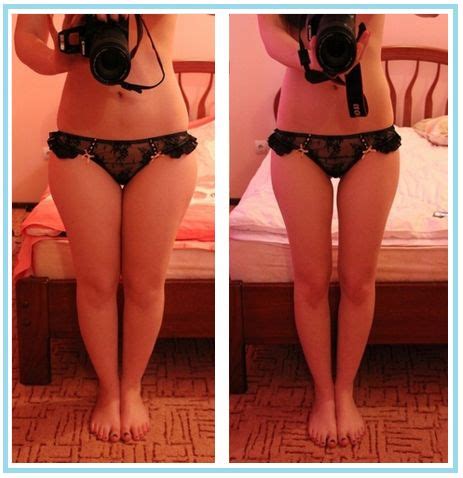 LEGS BEFORE AND AFTER WEIGHT LOSS - burmes fede