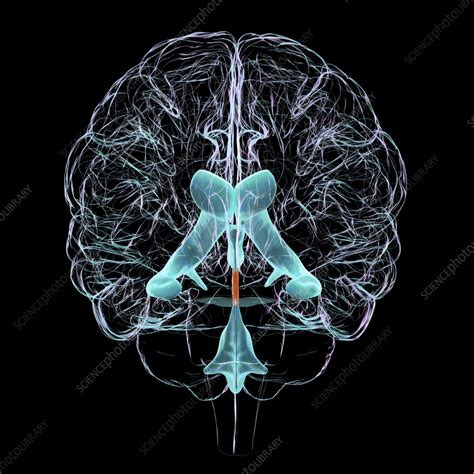 Cerebral aqueduct, illustration - Stock Image - F040/4184 - Science Photo Library