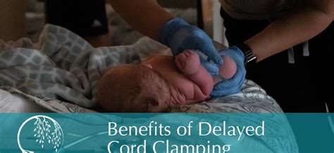 Benefits of Delayed Cord Clamping - Willow Birth & Wellness Center AZ